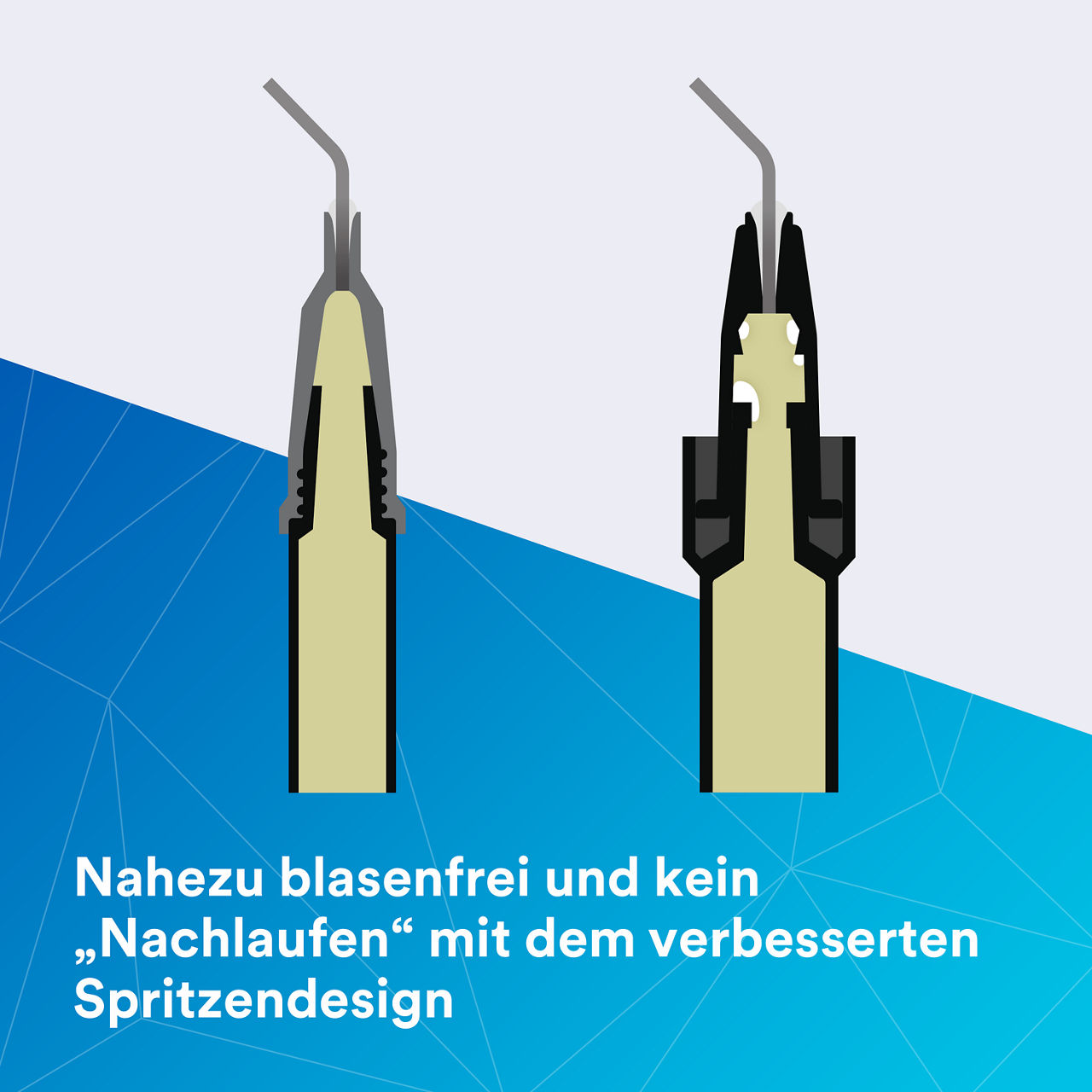 2- Filtek Supreme Flowable Syringe: Nahezu blasenfrei und kein „Nachlaufen“
