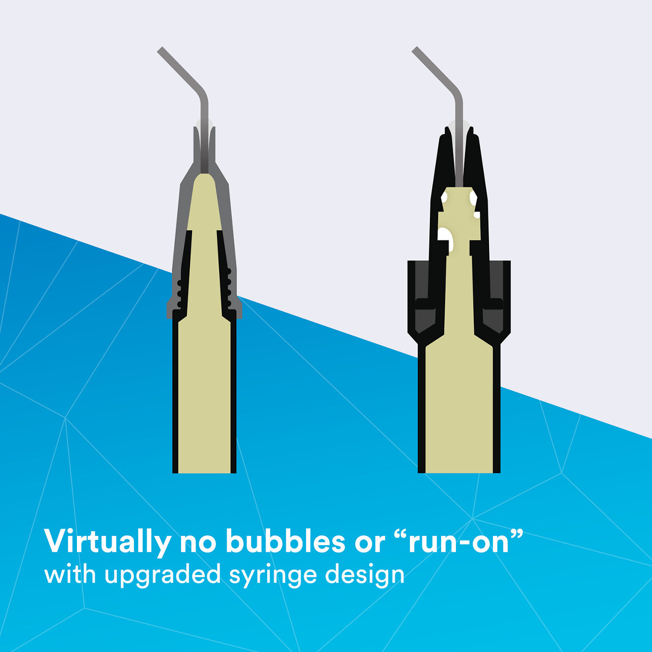 (2) Filtek Supreme Flowable, Syringe: Virtually no bubbles or "run-on"