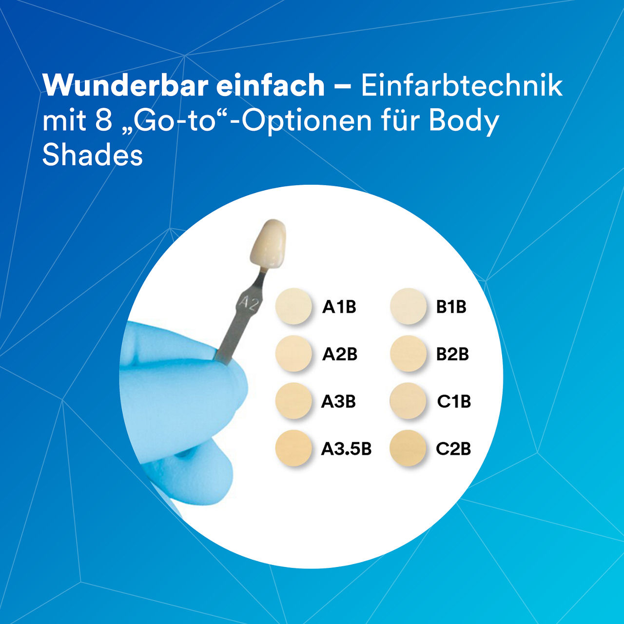 5- Filtek Supreme XTE: Wunderbar einfach – Einfarbtechnik mit 8 „Go-to“-Optionen für Body Shades