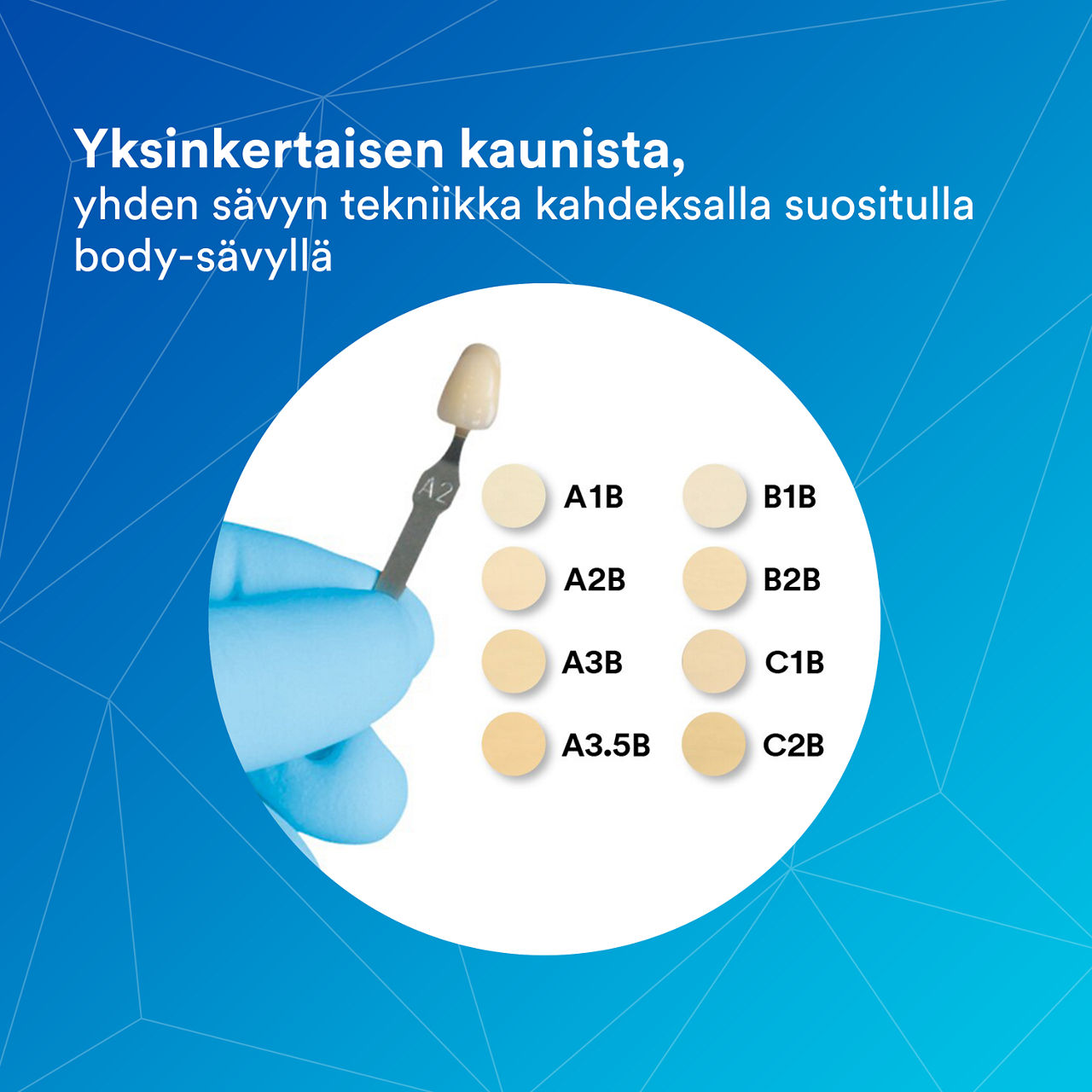 (5) Filtek Supreme XTE Universal: Kauniisti yksinkertainen