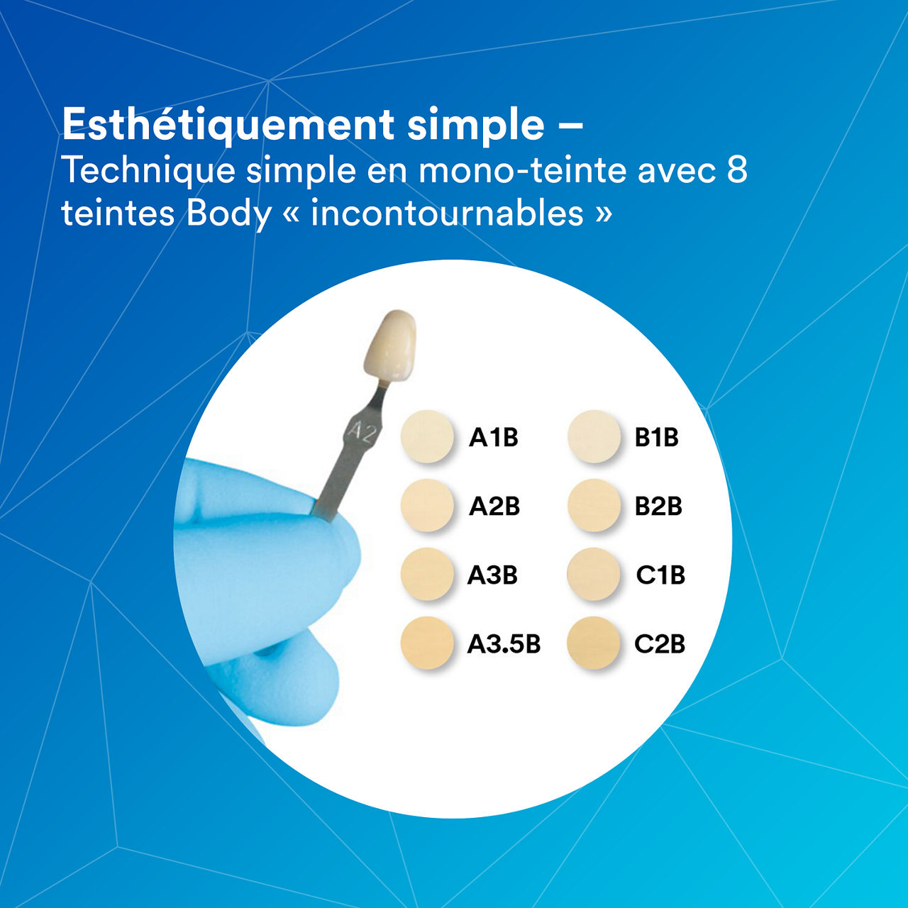 (5) Filtek Supreme XTE Universal: Beautifully Simple