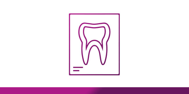 Radiopacity helps you see composites on a radiograph