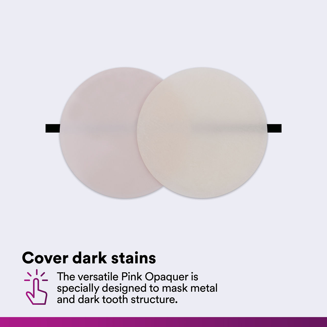 (3) Filtek Universal: Cover dark stains