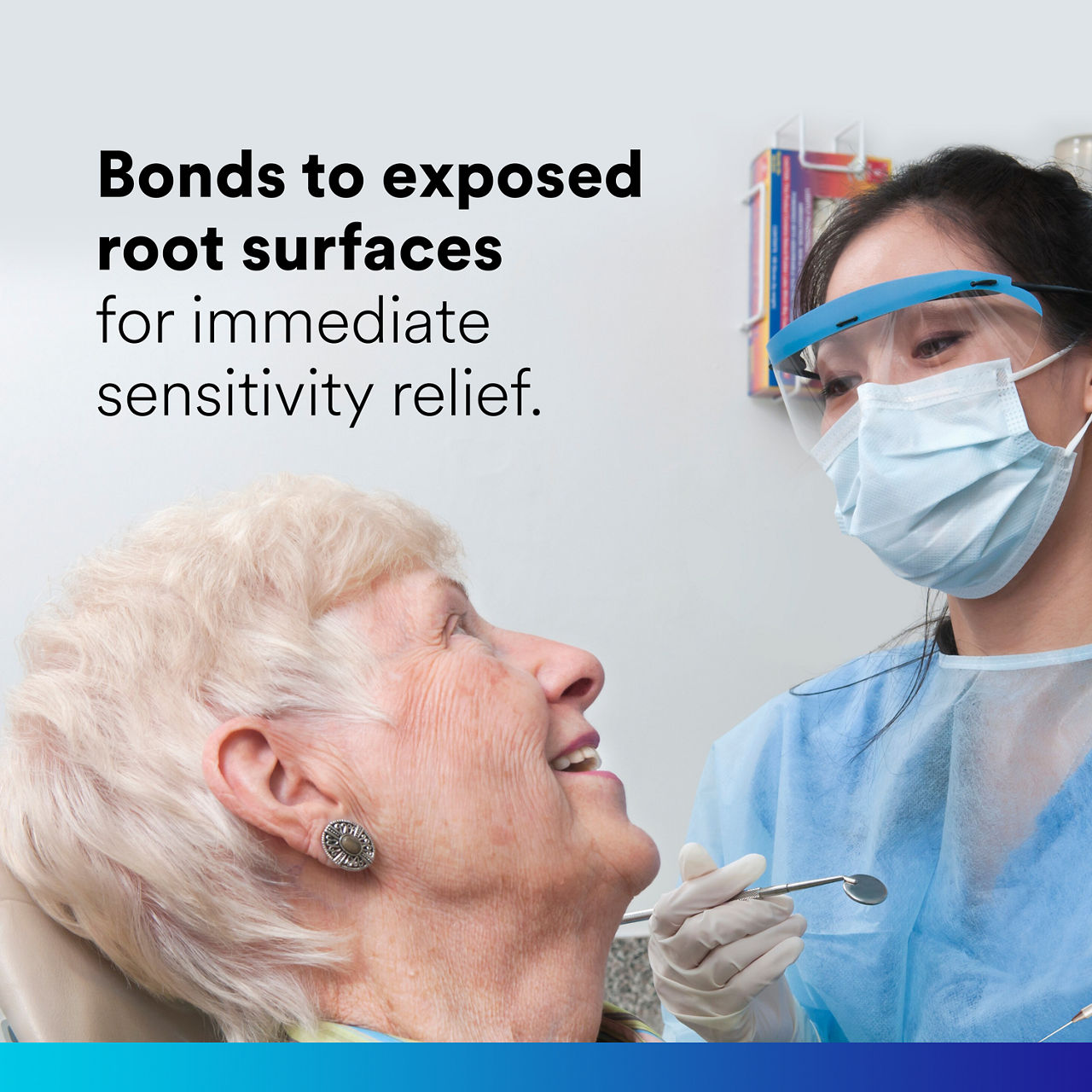 (1) Vanish XT: bonds to exposed root surfaces for immediate sensitivity relief