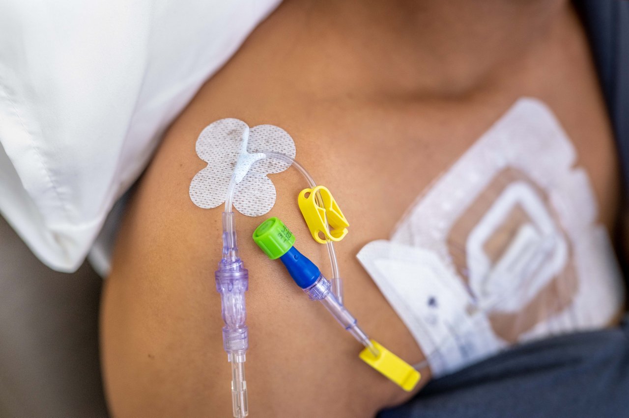 Entorno de oncología 8708 UCI