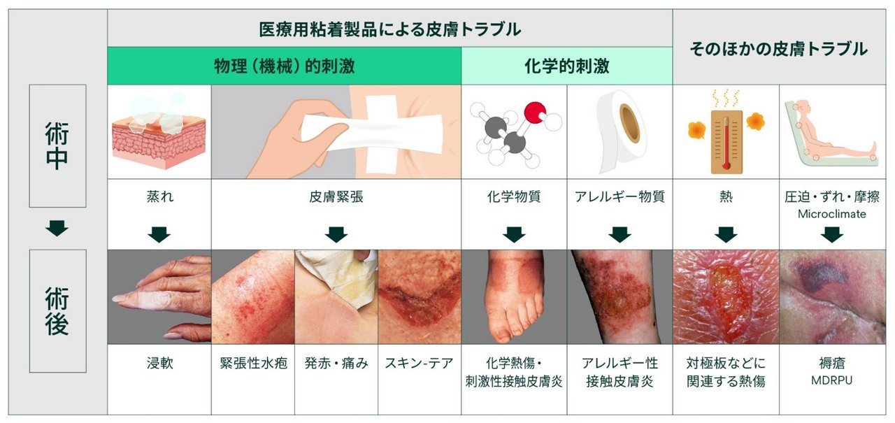 周術期の皮膚トラブルとその主な原因の一覧表です