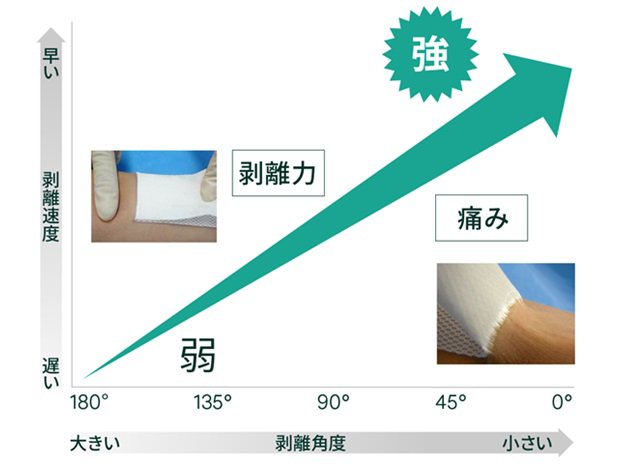 医療用粘着製品の剥離速度と剥離角度が与える影響のイメージ図です