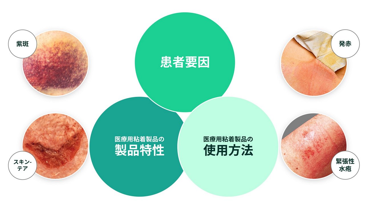 物理的(機械的)刺激による皮膚トラブルの３要因のイメージ画像です