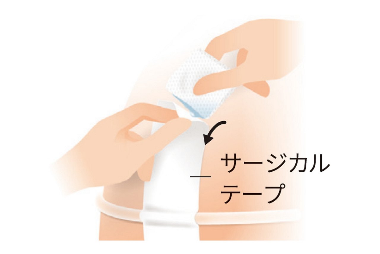 サージカルテープを少しつまみ、隙間に染み込ませます