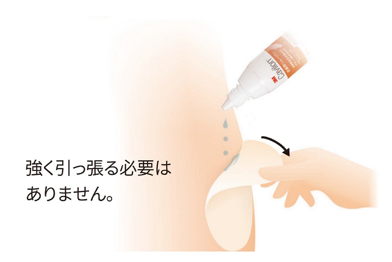 ストーマ装具を強く引っ張る必要はありません（TP1、TP1-L50）