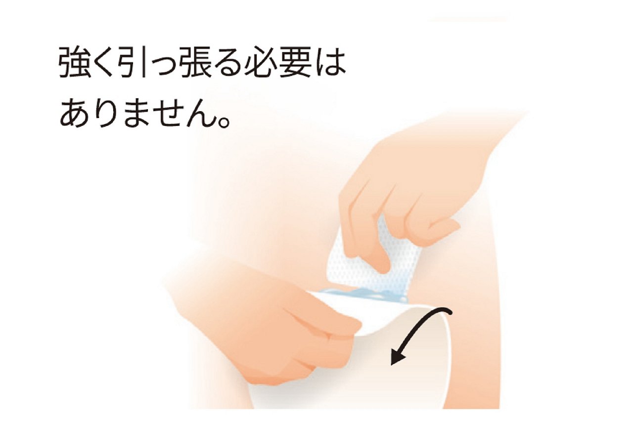 ストーマ装具を強く引っ張る必要はありません（TP2）