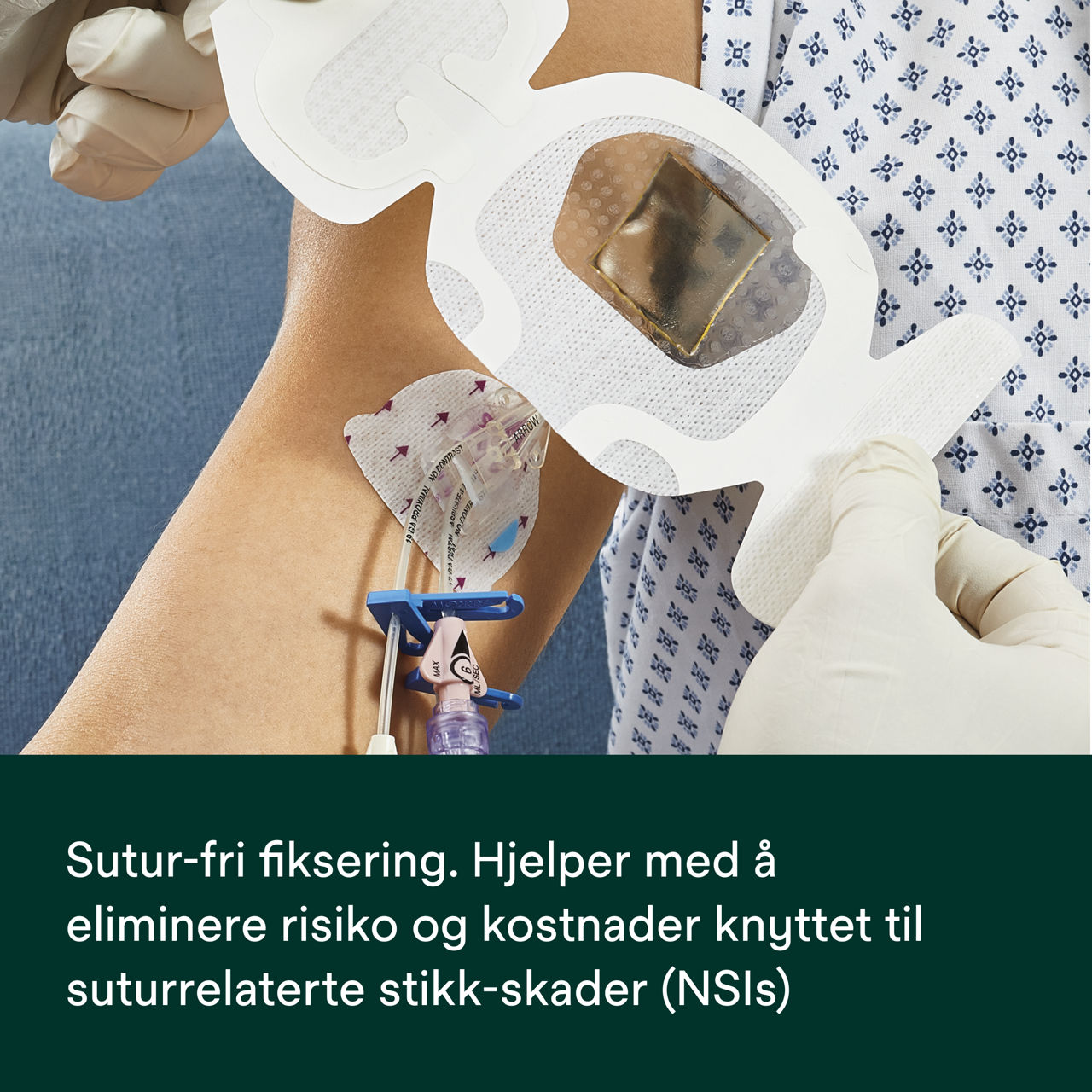 (3) PICC/CVC-enhet + CHG IV-forbinding: Suturløs sikring