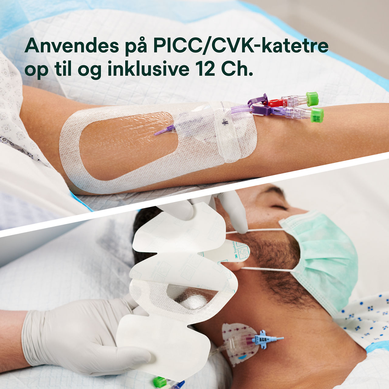 (4) 3M PICC/CVC + Tegaderm IV Advanced Fiksering: Anvendes på PICC/CVC katetre