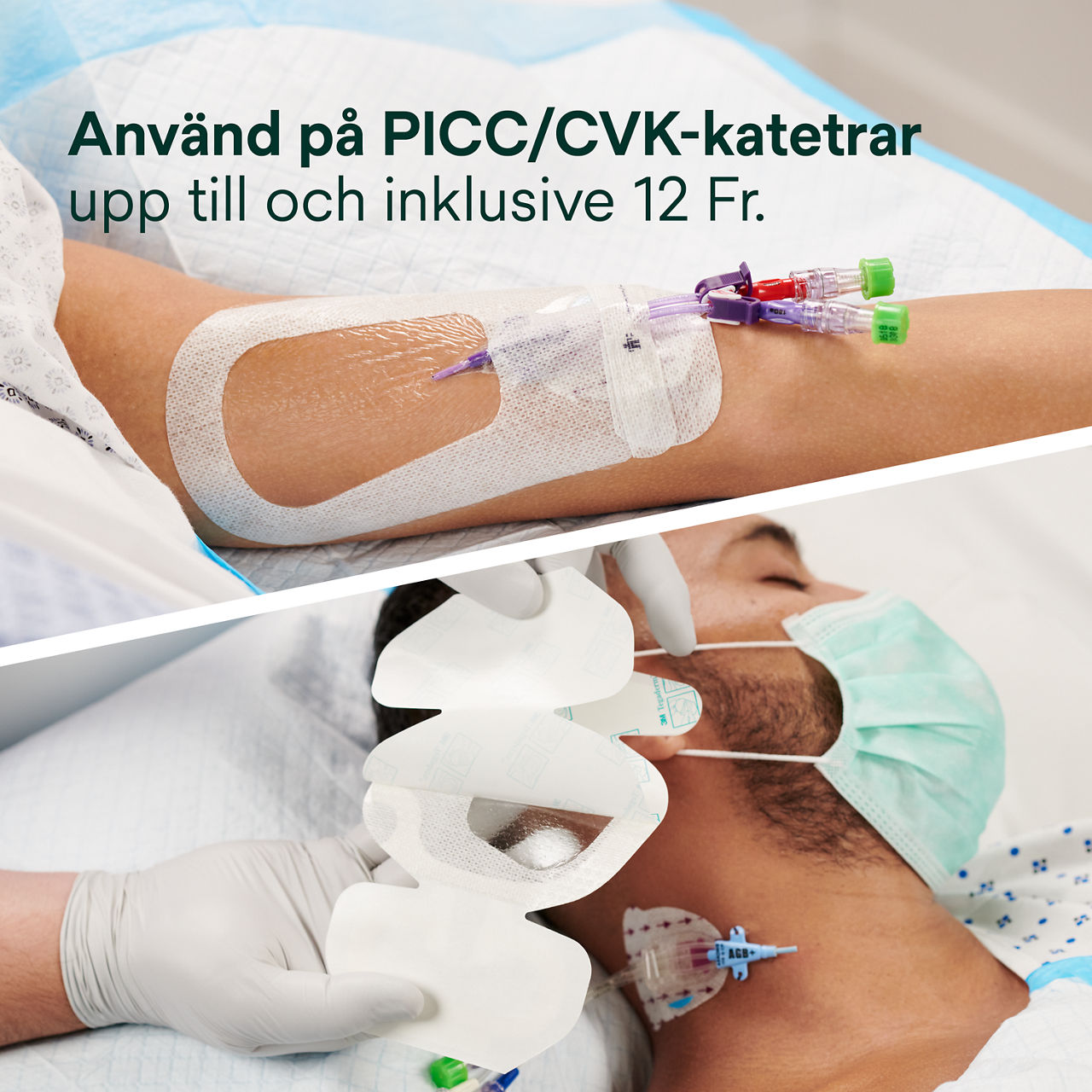 (4) 3M PICC/CVK + Tegaderm IV Advanced Fixering: Används på PICC/CVK katetrar