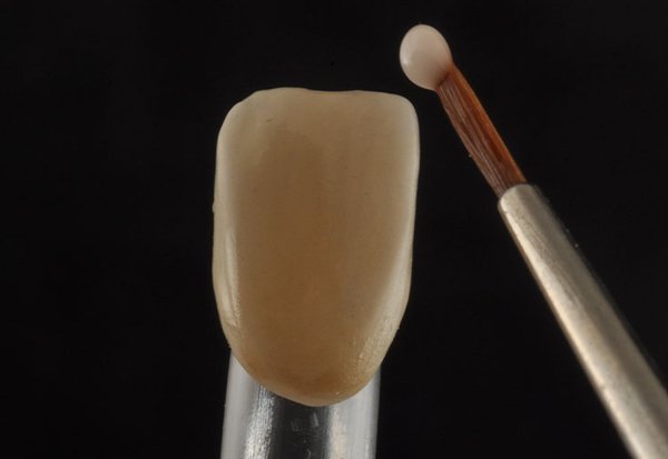 3M™ Scotchbond™ Universal Adhesive was applied