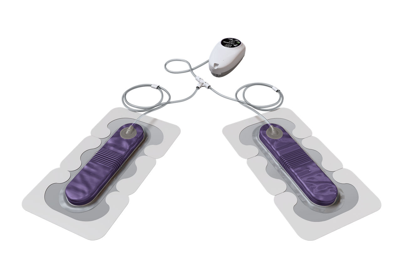 Kit de Sistema 3M™ Prevena™ Plus Duo, PRE3321US, 20 & 20 cm