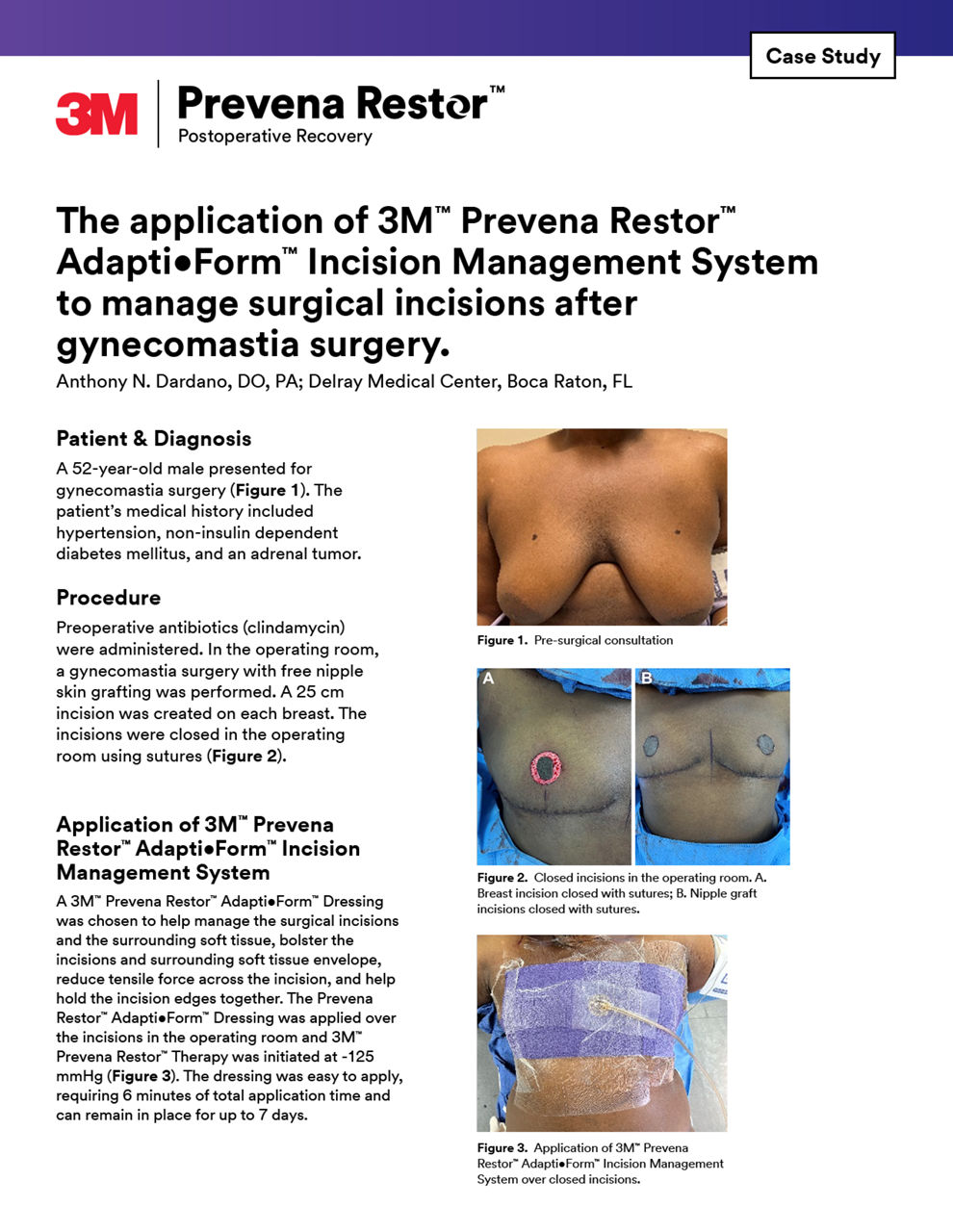 Prevena Therapy plastic surgery brochure cover preview