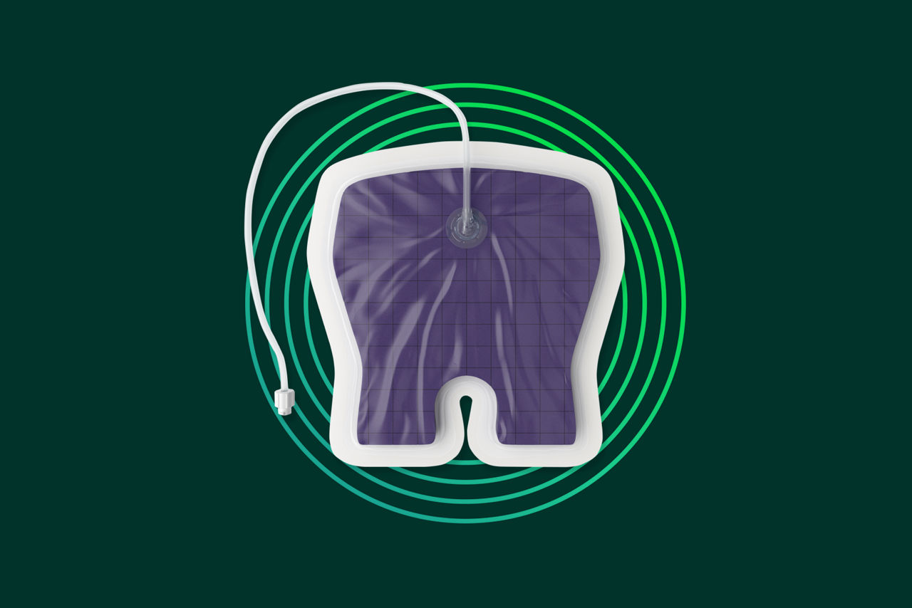 The next generation of NPWT closed incision and surrounding soft tissue management.
