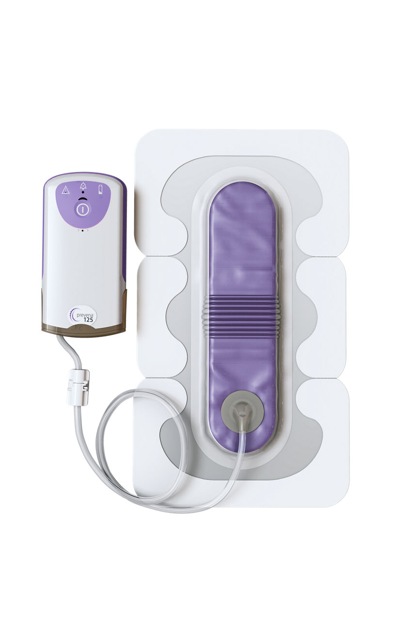 3M™ Prevena™ Peel and Place incisiemanagementsystesem