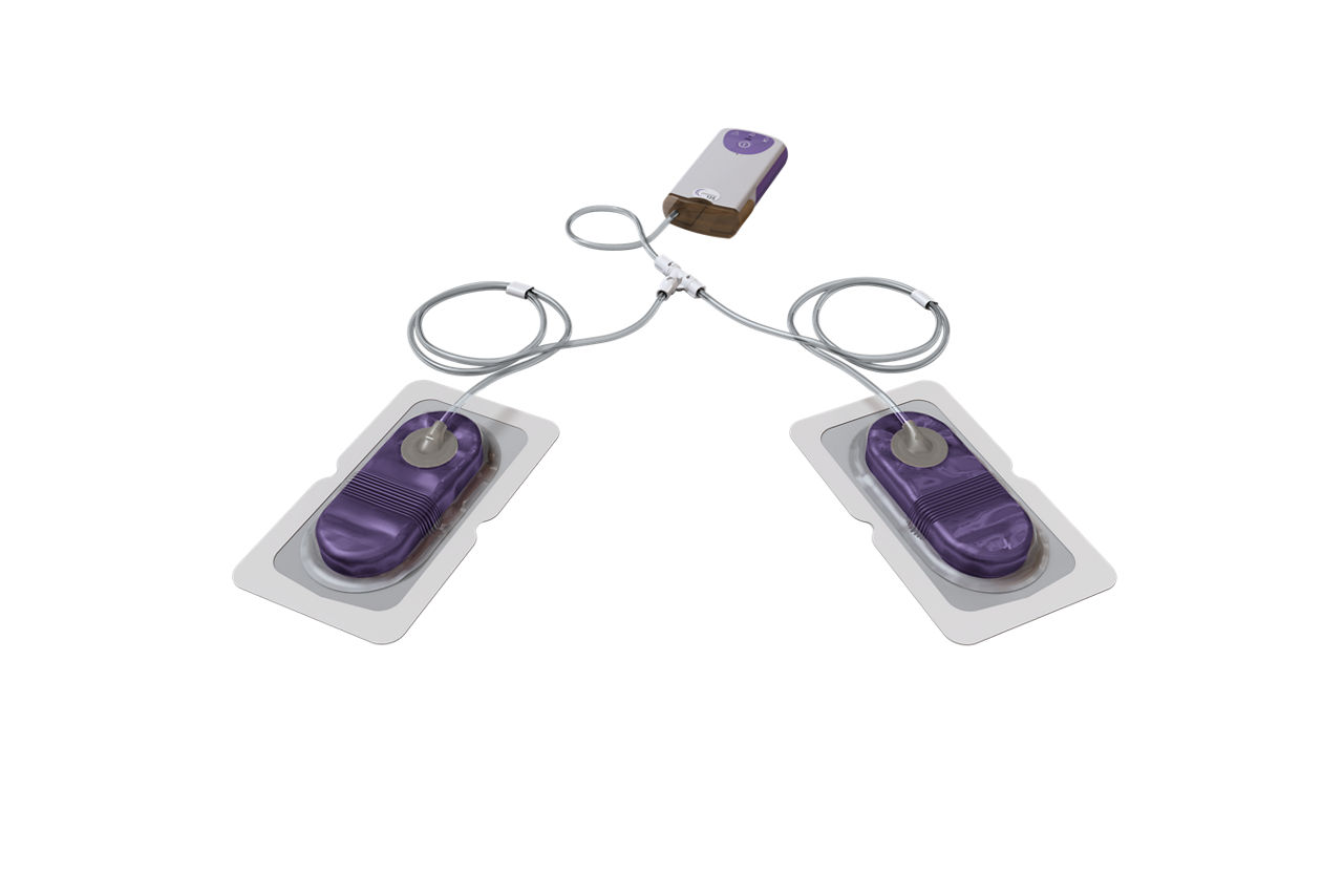 3M™ Prevena™ Duo Incision Management System