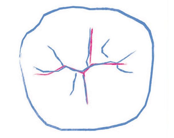 Recommended essential lines to be added to the uncured composite