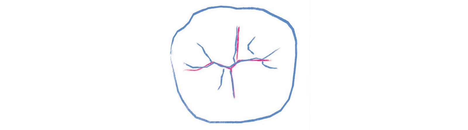 Recommended essential lines to be added to the uncured composite