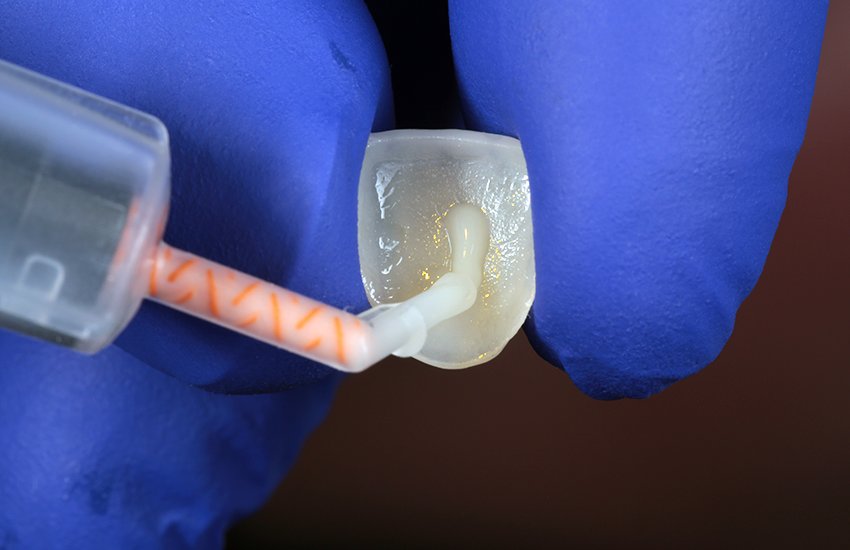 Informative oral care related imagery with a file name of Dr-Richard-Young.jpg shown on Solventum's "Brain Floss" blog