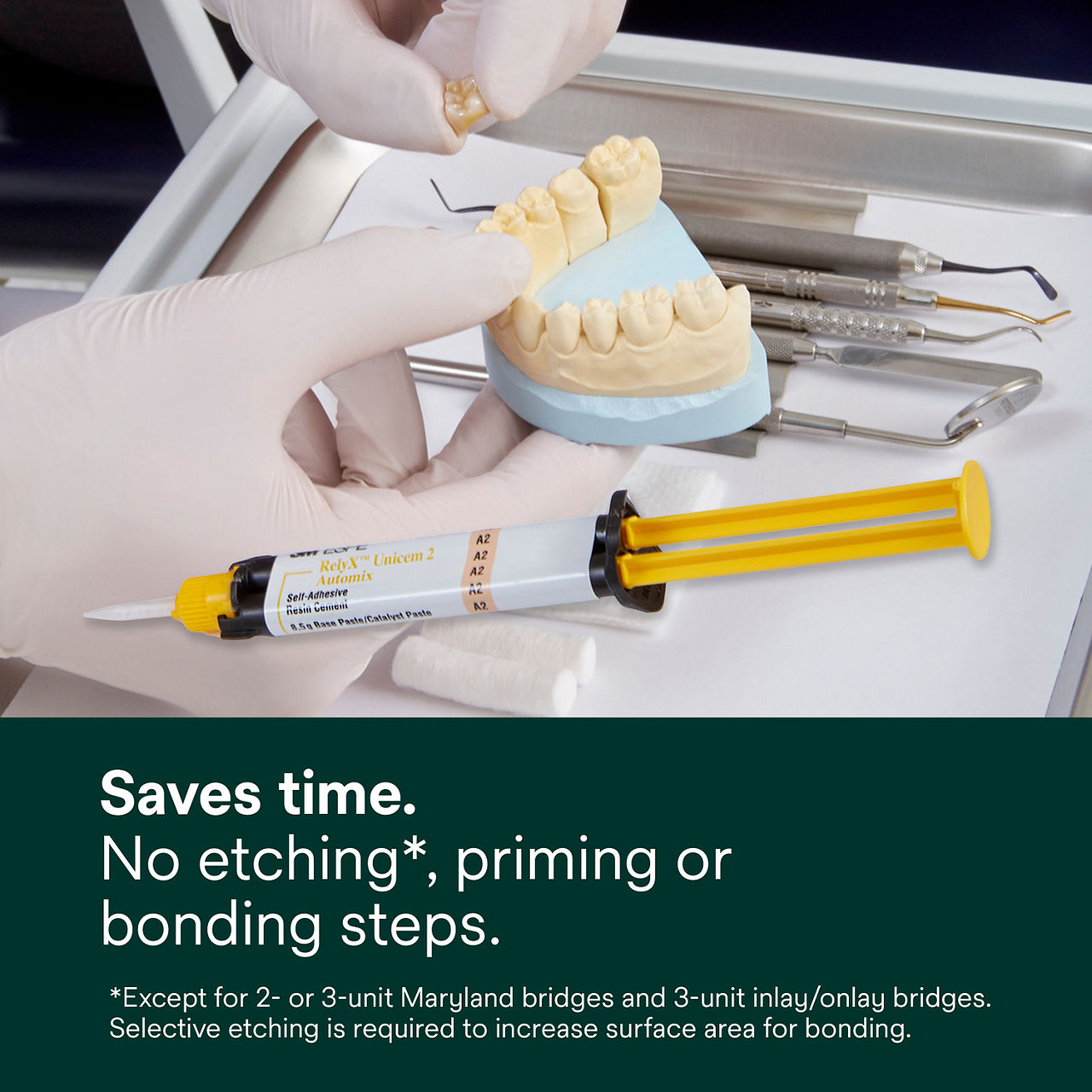 (2) RelyX Unicem 2 Self-Adhesive Resin Cement: Saves time. No etching*, priming or bonding steps