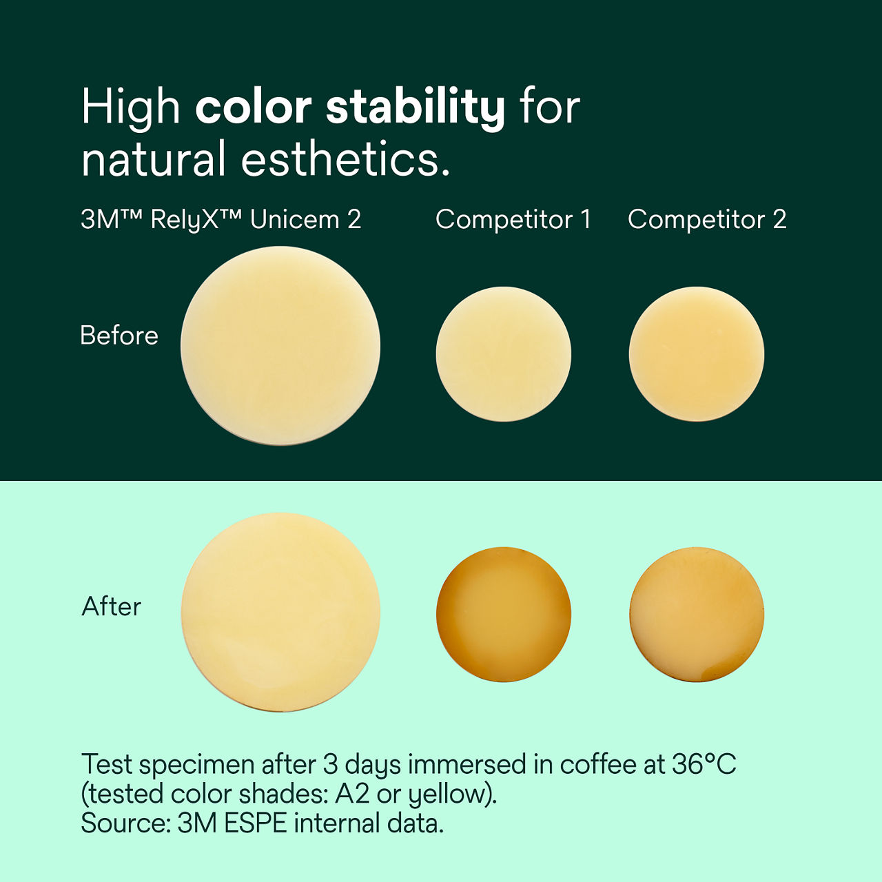 (4) RelyX Unicem 2 Self-Adhesive Resin Cement: High color stability for natural esthetics
