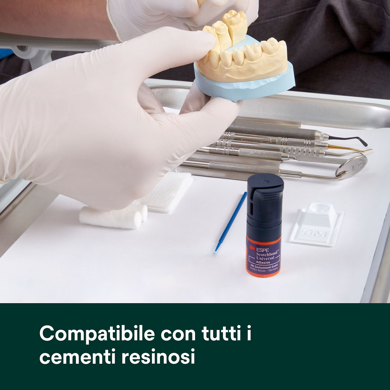 (5) Scotchbond Adesivo Universale: Compatibile con tutti i cementi in resina