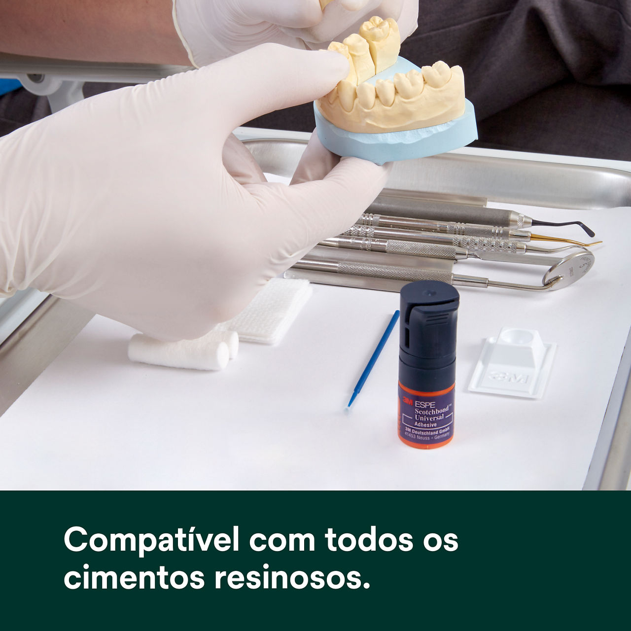 (5) Scotchbond Adesivo Universal: Compatível com todos os cimentos de resina