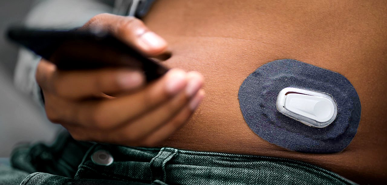 Man Testing Glucose Level With Continuous Glucose Monitor On Mobile Phone