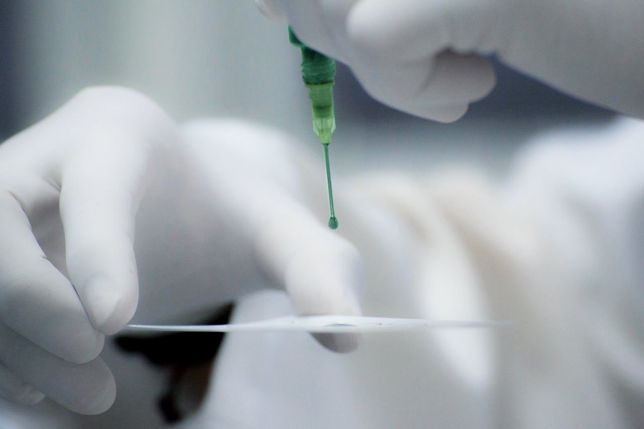 RPR, VDRL, Syfilis test