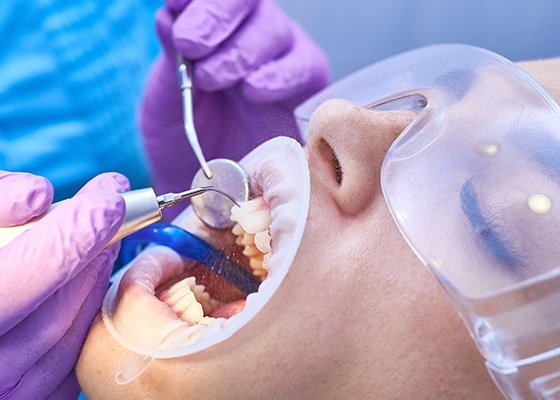 Informative oral care related imagery with a file name of 3M-RelyX-Resin-Cement-table-850x610-1.png shown on Solventum's "Brain Floss" blog