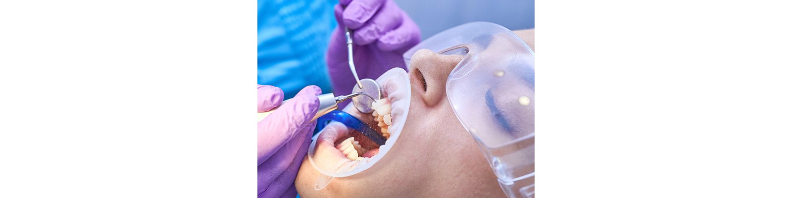 Informative oral care related imagery with a file name of 3M-RelyX-Resin-Cement-table-850x610-1.png shown on Solventum's "Brain Floss" blog