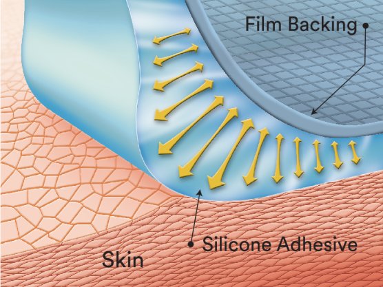 Silicone Adhesive Removal illustration/graphic