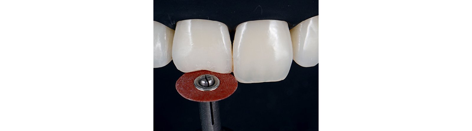 Creating a smooth, beveled surface