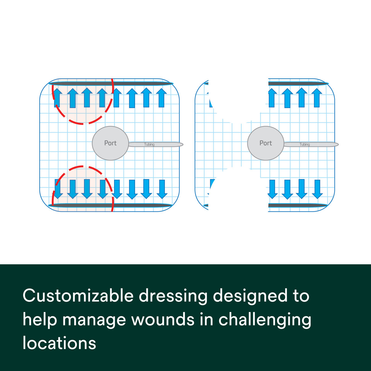 Snap Advanced Dressing Kit PDP Secondary Image 3