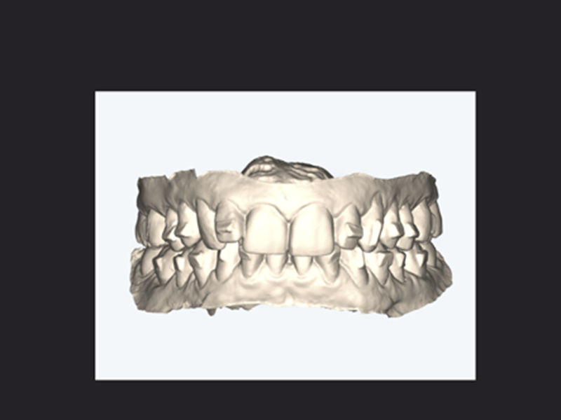 Case image 1