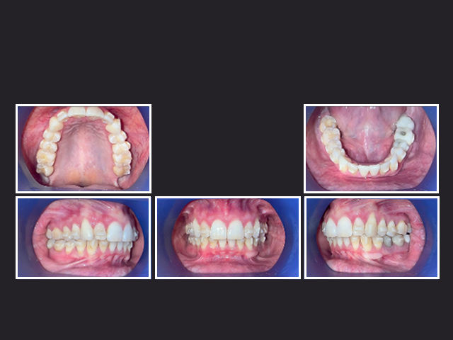 Case image 2