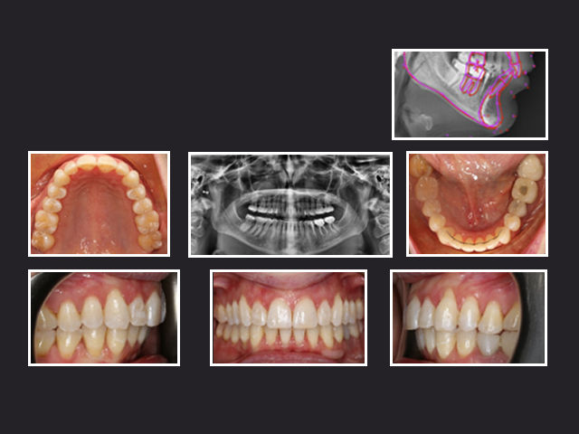 Case image 3