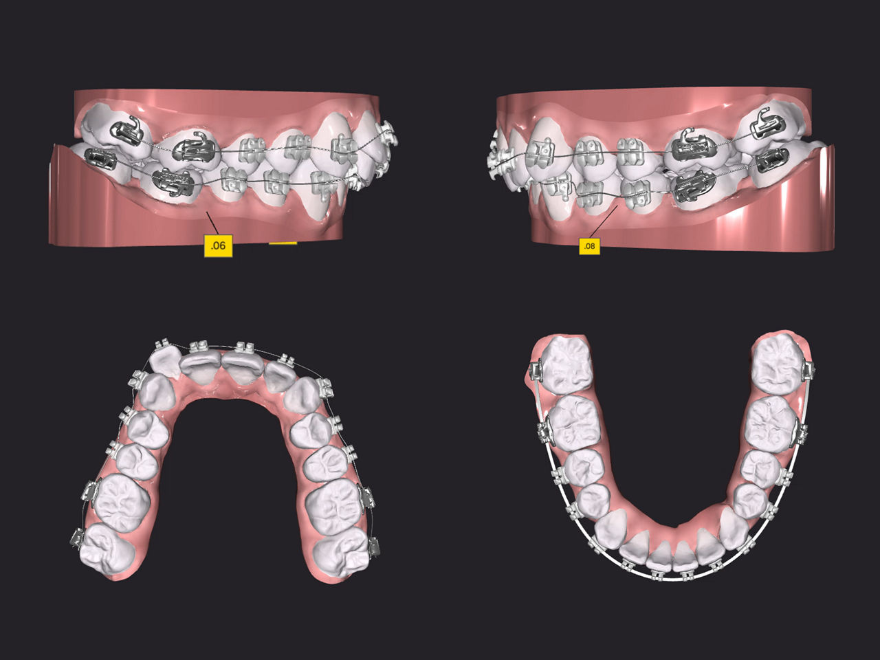 Treatment Design