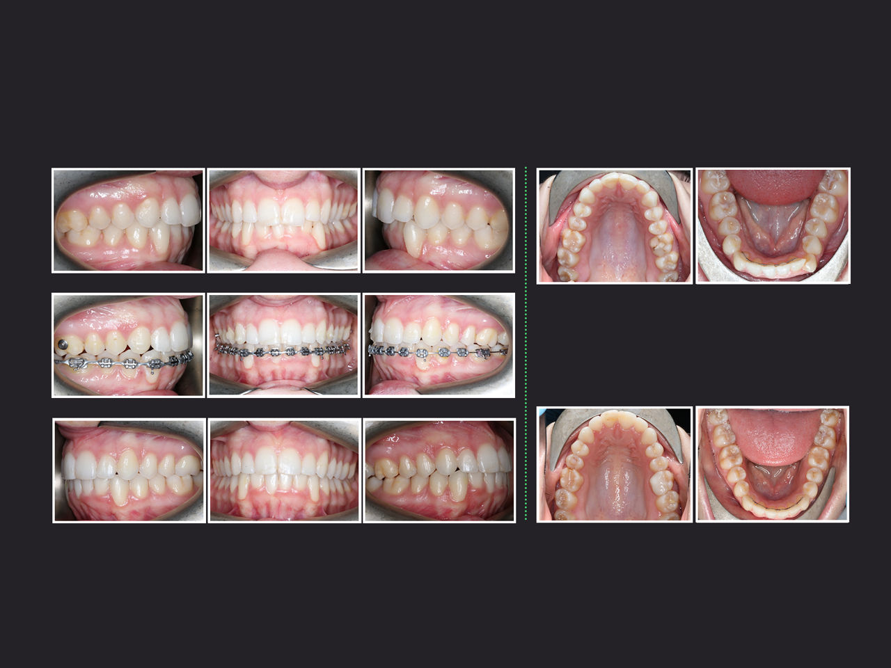 Before image