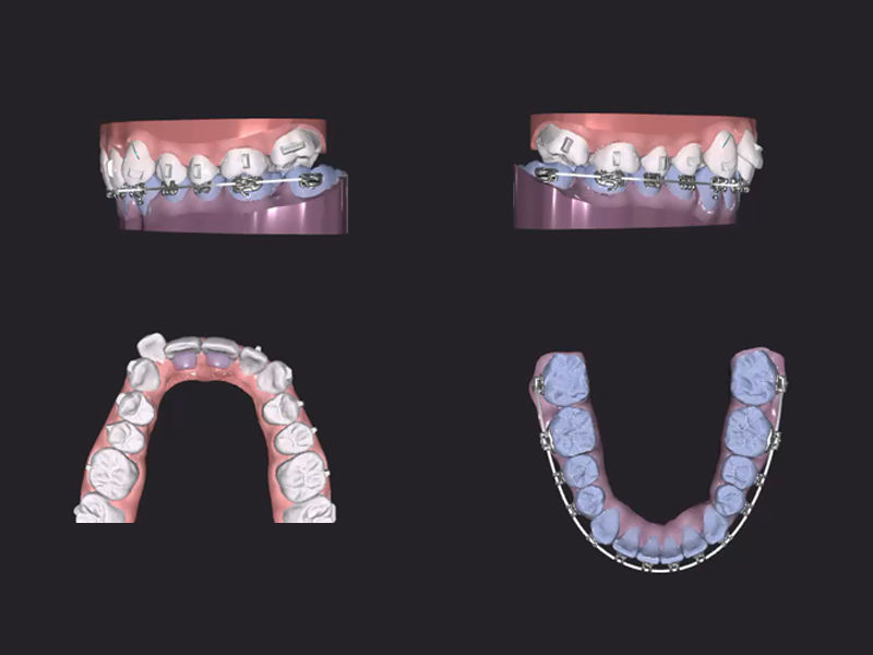 Treatment Design