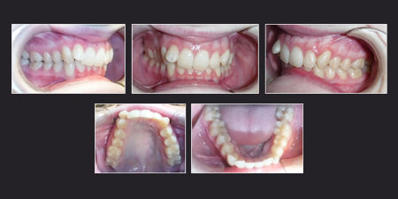 Clinical Case Example