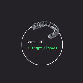 Clarity Aligners