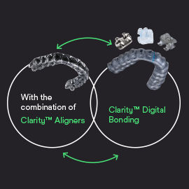 Combination of Clarity Aligners and Clarity Digital Bonding