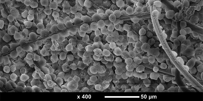 Chromatographic capture of cells to achieve single stage clarification in recombinant protein purification