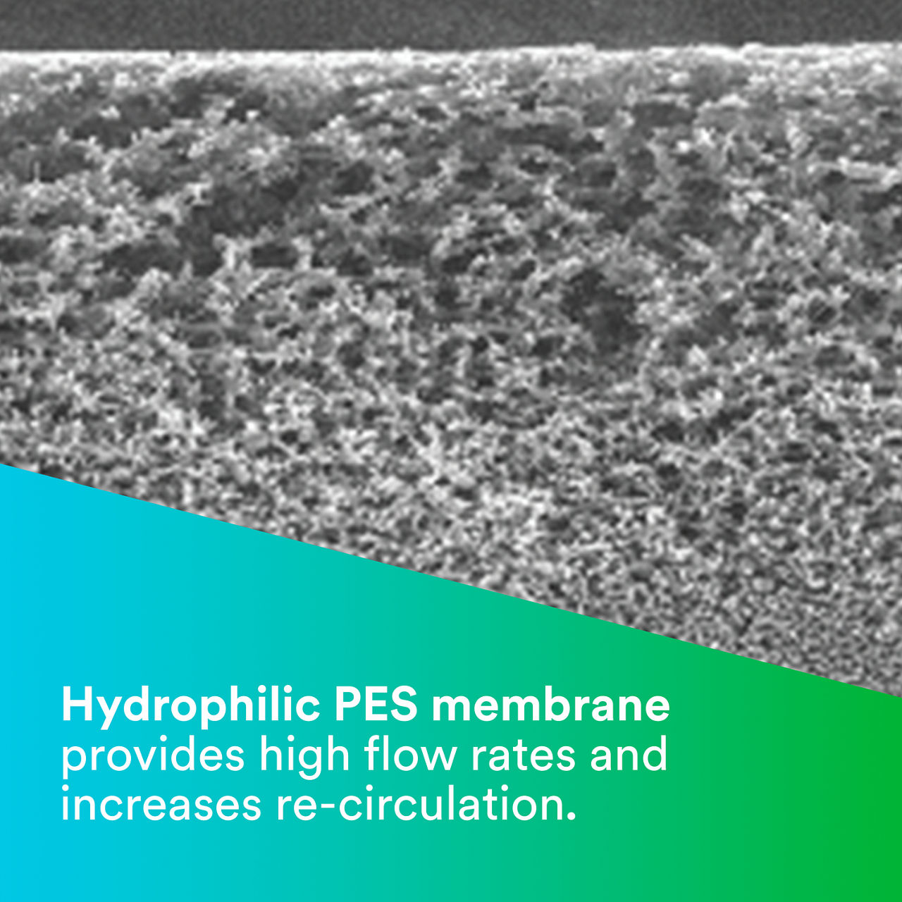 1 - LifeASSURE EPF: Hydrophilic PES membrane provides high flow rates