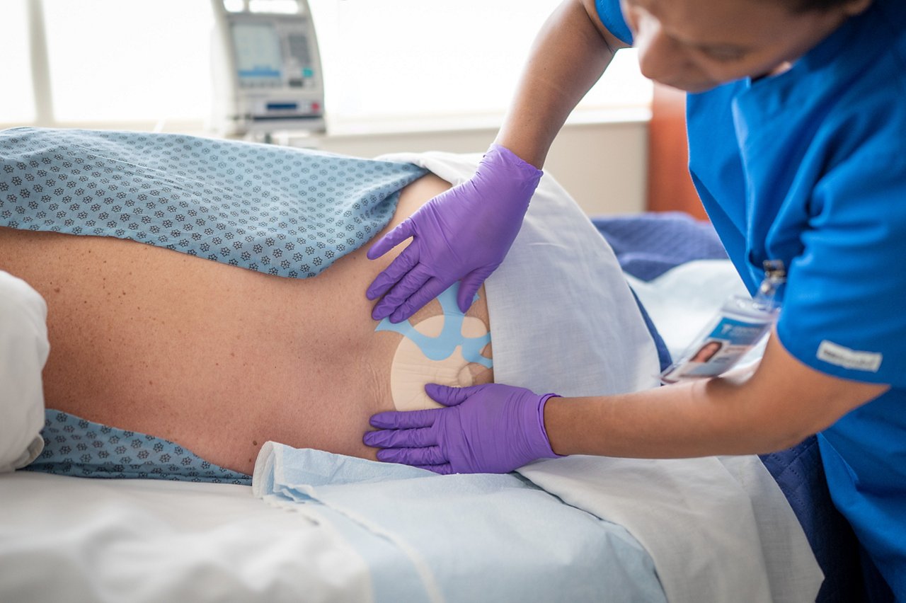 Clinician applying 3M™ Tegaderm™ Silicone Foam Dressing to patient's sacrum